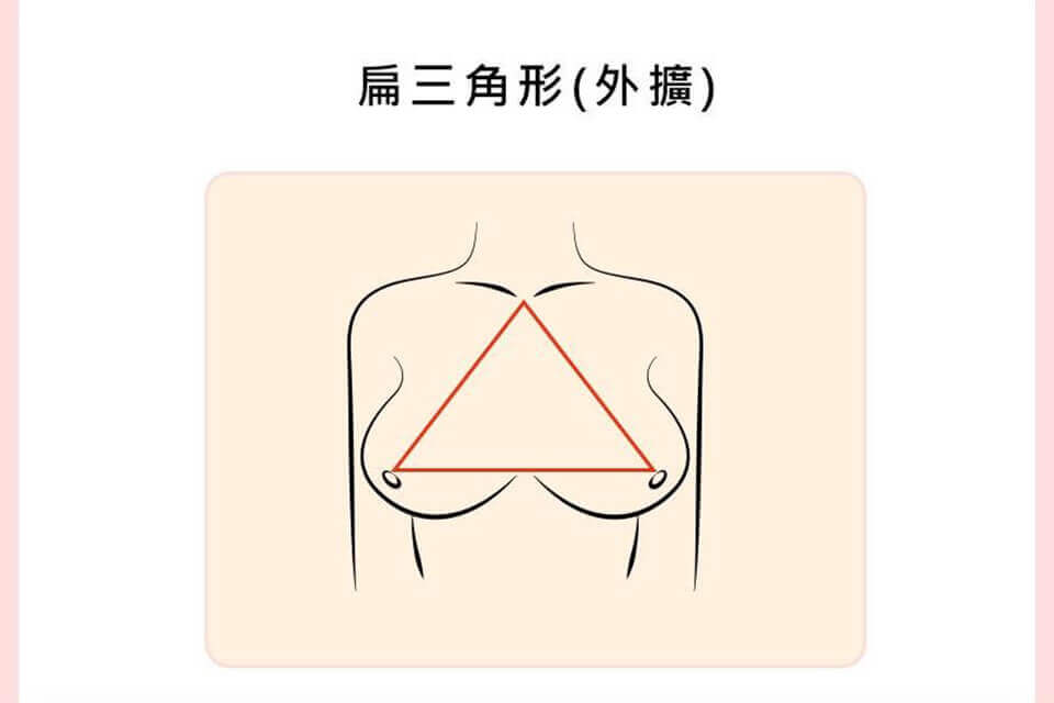 胸部外擴了嗎？胸部外擴定義這樣看，告訴你怎麼辦