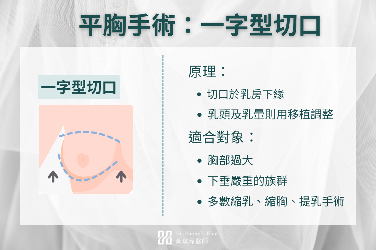 一字型切口平胸手術