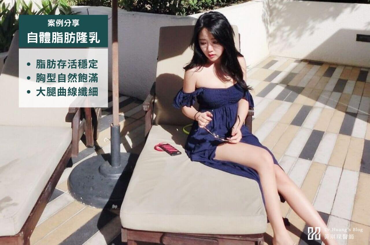 自體脂肪隆乳案例分享｜術前術後變化一次看