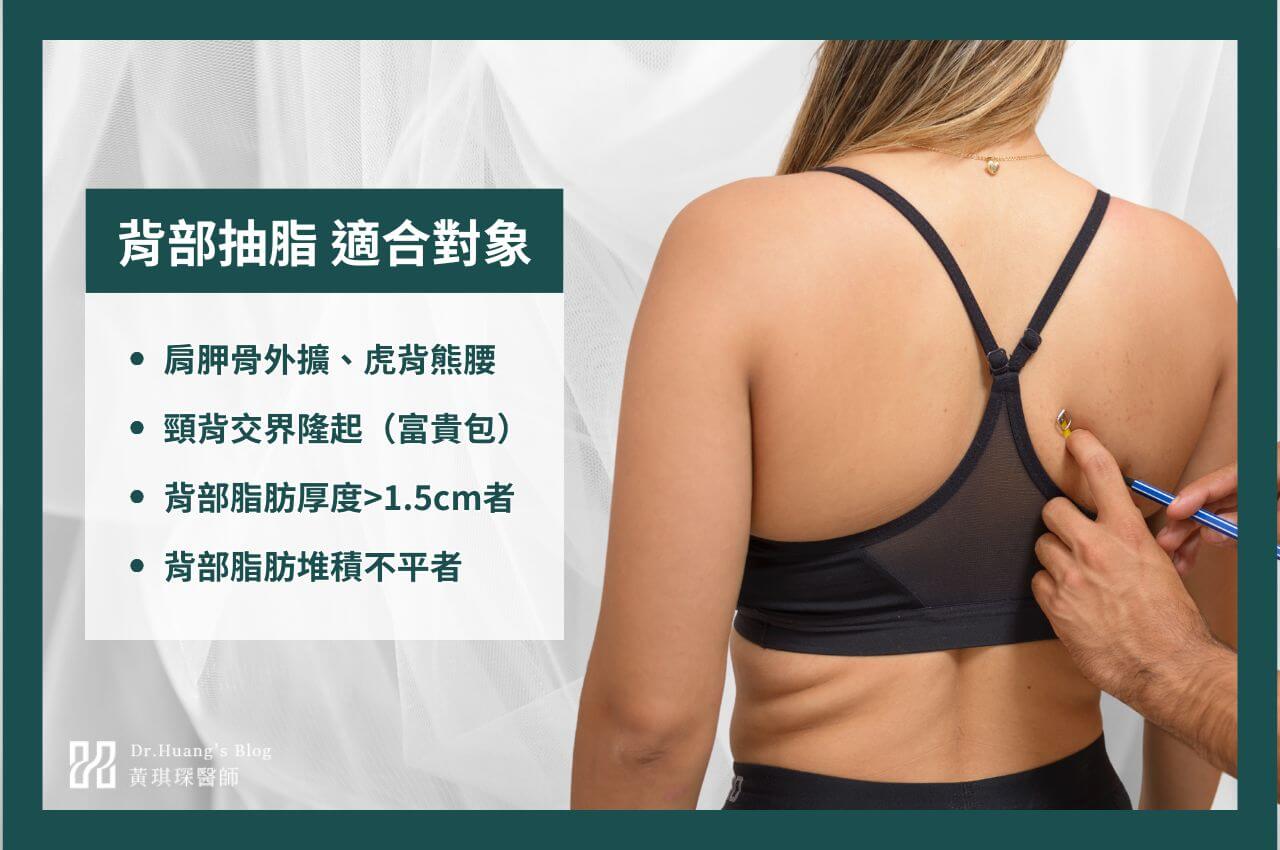 適合背部抽脂的族群