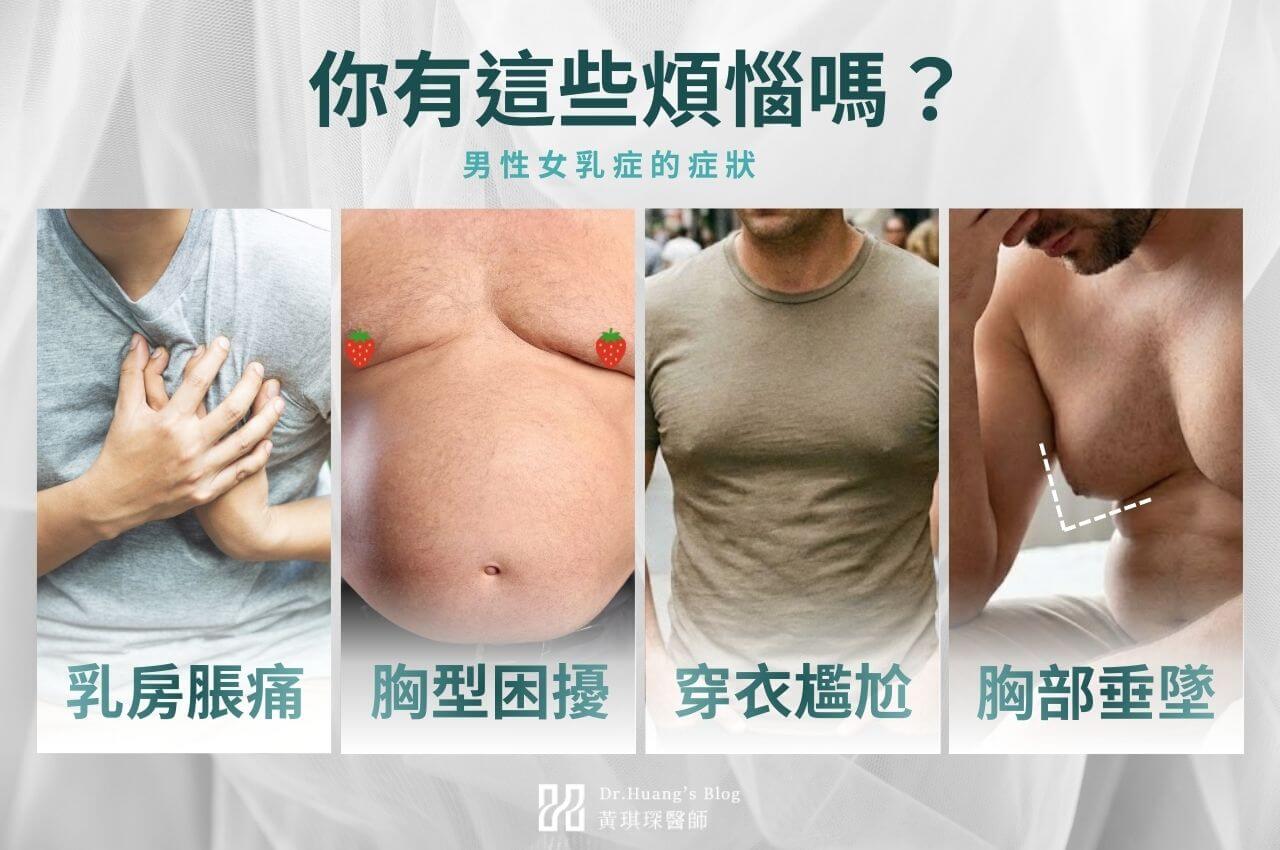 男性女乳症症狀