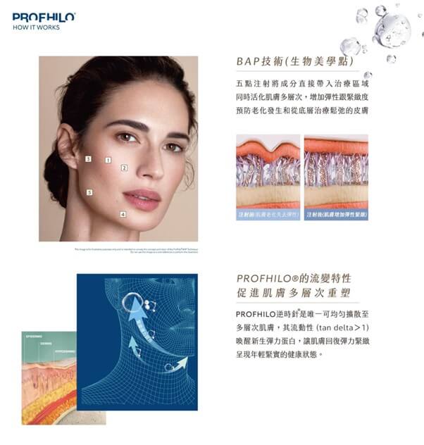 Profhilo逆時針BAP五點注射技術