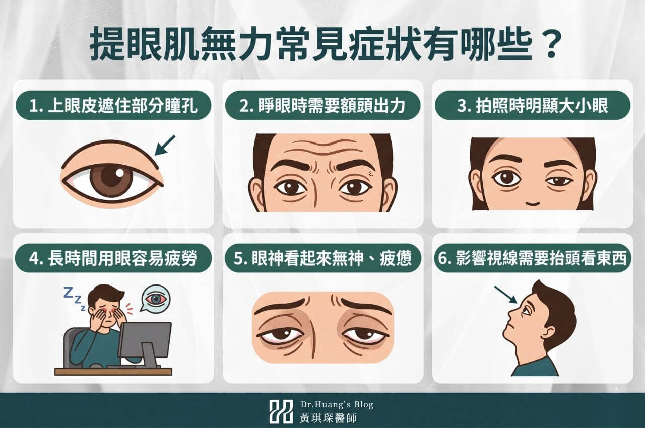 提眼肌無力的6種症狀
