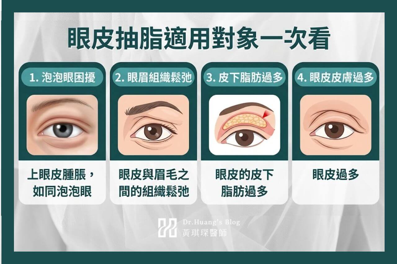 眼皮抽脂適合對象