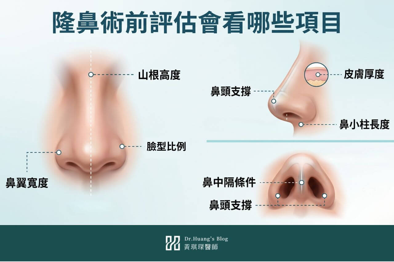 隆鼻術前評估會看哪些項目